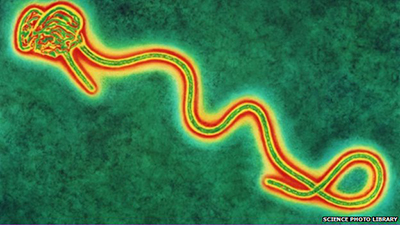 enlarged and colored image of a single Ebola virus