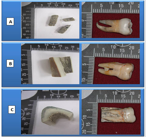 Bone fragments and teeth measurements